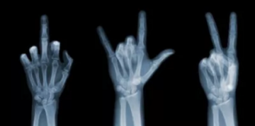 手机x光透视功能软件