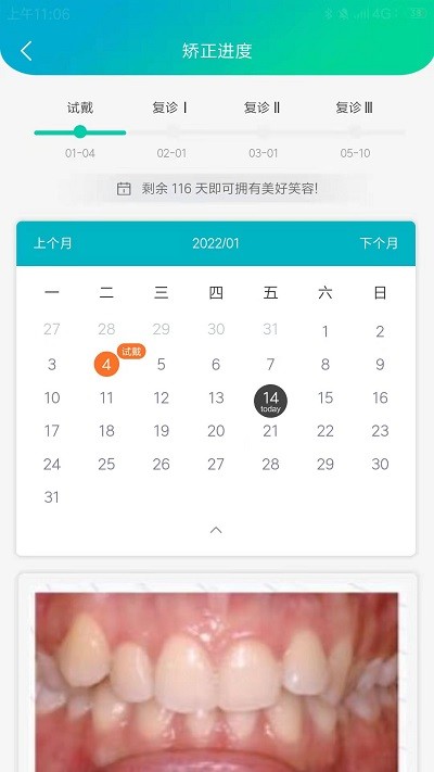 青椒美牙官方下载