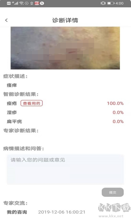 皮肤病诊断选药